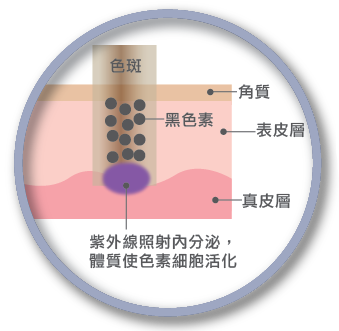  特证美白祛斑霜，跟“斑”说拜拜(图5)